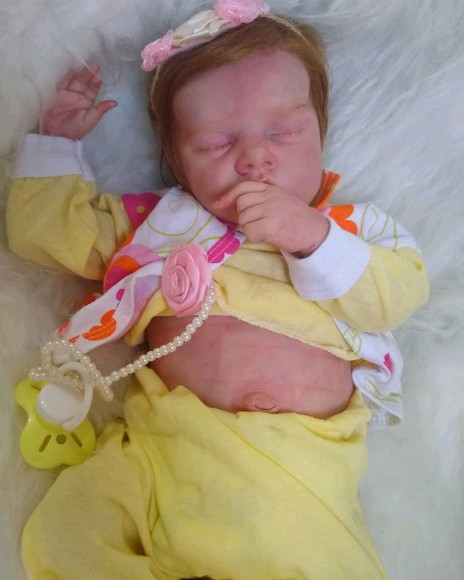 Imagem 2